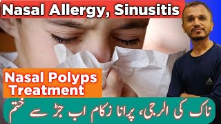 How To Sinusitis Treatment  Natural Medicine For Sinusitis  Nasal Polyps  Sinusitis [upl. by Nonnaer]