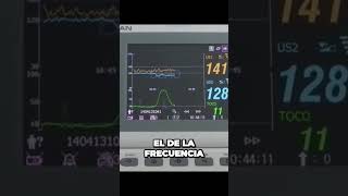 Cómo ESCUCHAR frecuencia Cardiaca Fetal Monitor fetal F6 [upl. by Eillit]