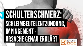 Schulterschmerz Schleimbeutelentzündung Impingement Orthopäde erklärt genau [upl. by Dnaletak]