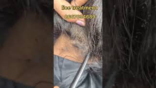 How to remove nits and lice treatment nits hair headlice haircare nitsremoval headliceremoval [upl. by Allit318]