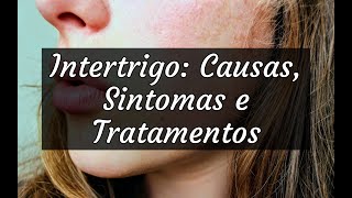 Intertrigo Causas Sintomas e Tratamentos [upl. by Aniluap]