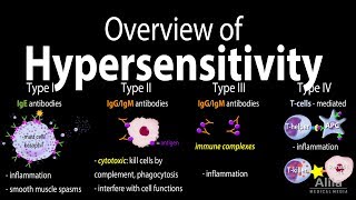 Hypersensitivity Overview of the 4 Types Animation [upl. by Alethea]