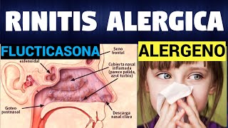 TODO SOBRE RINITIS ALERGICA  Síntomas Diagnostico y Tratamiento [upl. by Circosta925]