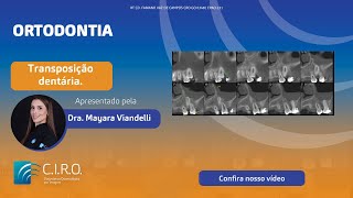 Transposição dentária  Caso Clínico com a Dra Mayara Viandelli [upl. by Radford]