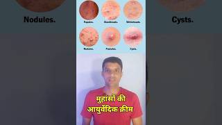 मुहांसों की हर्बल क्रीम।।acne removal creamacne killeraqui plus cream [upl. by Anairotciv]