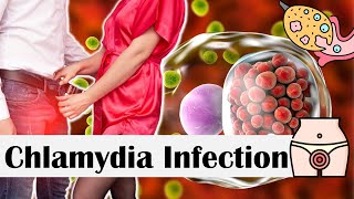 Chlamydia Infection  Causes Risk Factors Transmission Signs amp Symptoms Diagnosis amp Treatment [upl. by Aicatsal765]