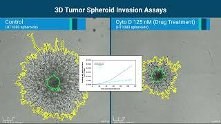 Monitoring and Quantifying 3D Spheroid Invasion by RTCA eSight Live Cell Analysis System [upl. by Corena]