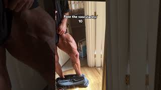 Rate the vascularity10 [upl. by Jet]