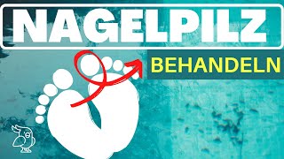 🚀NAGELPILZ NATÜRLICH BEHANDELN🚀 12 Hausmitel gegen Nagelpilz Nagelpilz Behandlung leicht gemacht [upl. by Machos571]