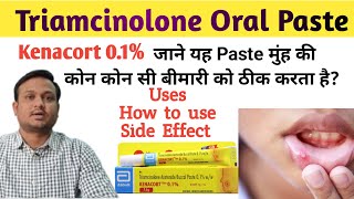 Kenacort 01  Kenacort gel how to use  Triamcinolone oromucosal paste bp 01 ww in hindi [upl. by Ferrand]