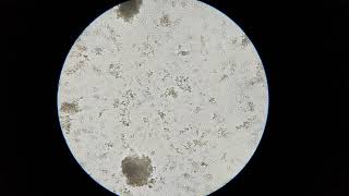 Lactobacillus bulgaricus  Streptococcus thermophilus [upl. by Toogood]