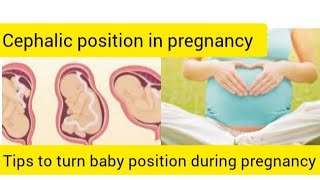 Cephalic presentation in tamilbaby positiontips to turn baby head down positionpregnancy tips [upl. by Leontina]