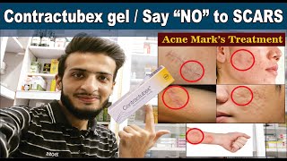 Contractubex gel  Get rid of SCARS Quickly  Uses amp Sid effects  Acne Scars Treatment  O Beauty [upl. by Nigle394]