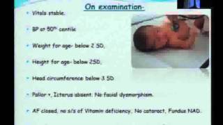 Case presentation on a child with Tyrosinemia [upl. by Ailemor250]