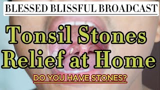 Tonsil Stones Relief at Home 2024 [upl. by Atile]