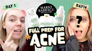 Honest Review 14 days WITH MARIO BADESCU Acne Repair Kit [upl. by Yetnom891]