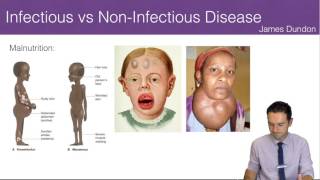 Infectious vs NonInfectious Disease [upl. by Tnairb]