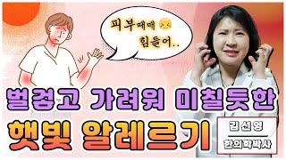 대구울산부산창원 햇빛알레르기 간지럽고 따가운 피부 염증반응 가려움 알러지검사 항히스타민제 스테로이드 소용없다면 원인은 피부 면역력 근본 치료법 포항구미경주안동밀양 청담미한의원 [upl. by Immij387]