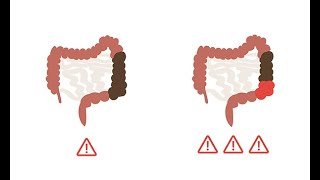 Medical Internship survival course How to evaluate for bowel obstruction [upl. by Enak]