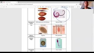 Trematodes Flukes Filipino [upl. by Shepherd553]