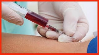 Extracción de Sangre con Jeringa✅ Toma de Muestra Sanguínea [upl. by Assilram822]