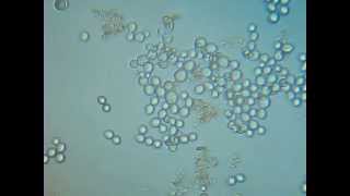 Brewers Yeast Saccharomyces cerevisiae [upl. by Eerehs236]