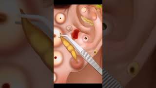 Asmr ear cleaning video  asmr ear cleaning video [upl. by Naujud]