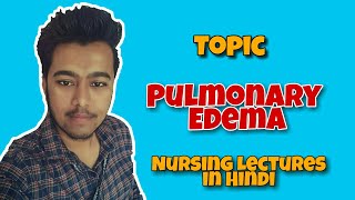 Pulmonary Edema  Nursing lecture in Hindi MSN 1 [upl. by Anirret]