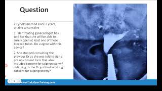 EndoGyneTraining Quiz 6 Tubal Cornual Block [upl. by Assej285]