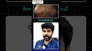 తిన్న వెంటనే మోషన్ వెళ్తున్నారా అయితే ఈ వీడియో చూడండిDrVikranth Chunduri [upl. by Agosto]