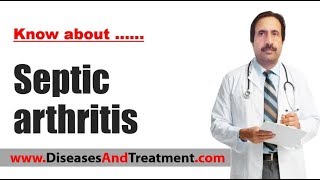 Septic arthritis  Causes Diagnosis Symptoms Treatment Prognosis [upl. by Yknarf]