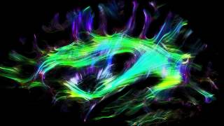 Wiring the human brain  Slicing fiber tractography [upl. by Genaro]