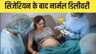 कब हो सकती है Cesarean के बाद Normal Delivery [upl. by Asennav218]