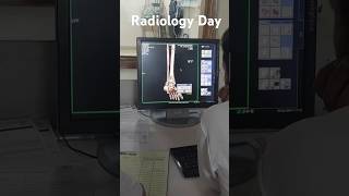 International Day Of Radiology Is Celebrated Every Year on 8th November internationaldayofradiology [upl. by Llerud]