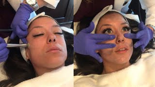 DERMASWEEP FACIAL l REVIVE AESTHETICS amp WELLNESS CENTER [upl. by Salsbury]