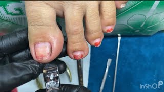 Home Pedicure Daily Vlog💅 IngrownDryskin Removal JeanManicurista [upl. by Narbig]