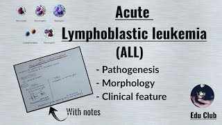 ALL Acute Lymphoblastic LeukemiaLymphoma  Disorders of White Cells  Lymphoid neoplasm Pathology [upl. by Kcirdneh]