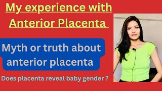 My experience with Anterior placentaAnterior Placenta complications and baby gender [upl. by Yendic]