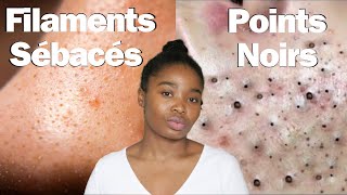 POINTS NOIRS et FILAMENTS SÉBACÉS c est quoi la DIFFERENCE [upl. by Junna]