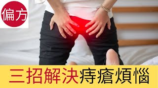 痔瘡自然療法｜三招解決痔瘡煩惱 [upl. by Muns]