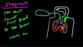 The Four Types Of Hypoxia [upl. by Treborsemaj672]