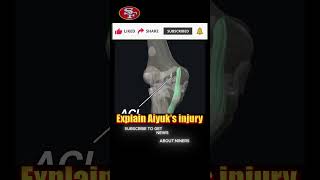 Thats what happened with Aiyuks knee injury😖😭NINERS FAST NEWS 49ERSNEWS [upl. by Aisiram]