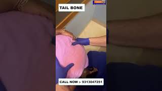 TAIL BONE  Chiropractic Treatment in Delhi  Dr Varun  Call  9313047251 doctor delhi noida [upl. by Nnairol433]