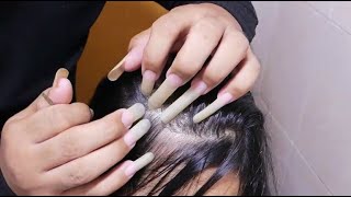 ASMR Scratch Itchy Scalp So I Did Satisfying Scalp Scratching No Talking [upl. by Anauqes]