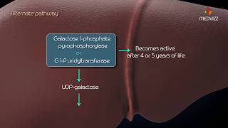 Metabolism of galactose Classic Galactosemia Galactokinase deficiency [upl. by Catriona]