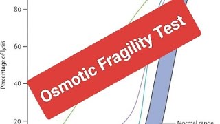 Leading Causes of Pediatric Normocytic Chronic Hemolysis HS [upl. by Otreblif]