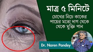 Only 5 mins Eye rejuvenation Get rid of under eye wrinkles eye bags Crows feet BENGALI [upl. by Koo]