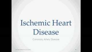 Ischemic Heart Disease  USMLE Step 2 Review [upl. by Head]