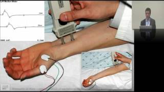 25 Interpreting neurophysiology EMG amp NCS [upl. by Reiss]