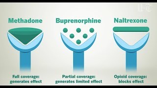 How Opioid Treatment Medications Work On Your Brain  San Diego UnionTribune [upl. by Ainuj187]